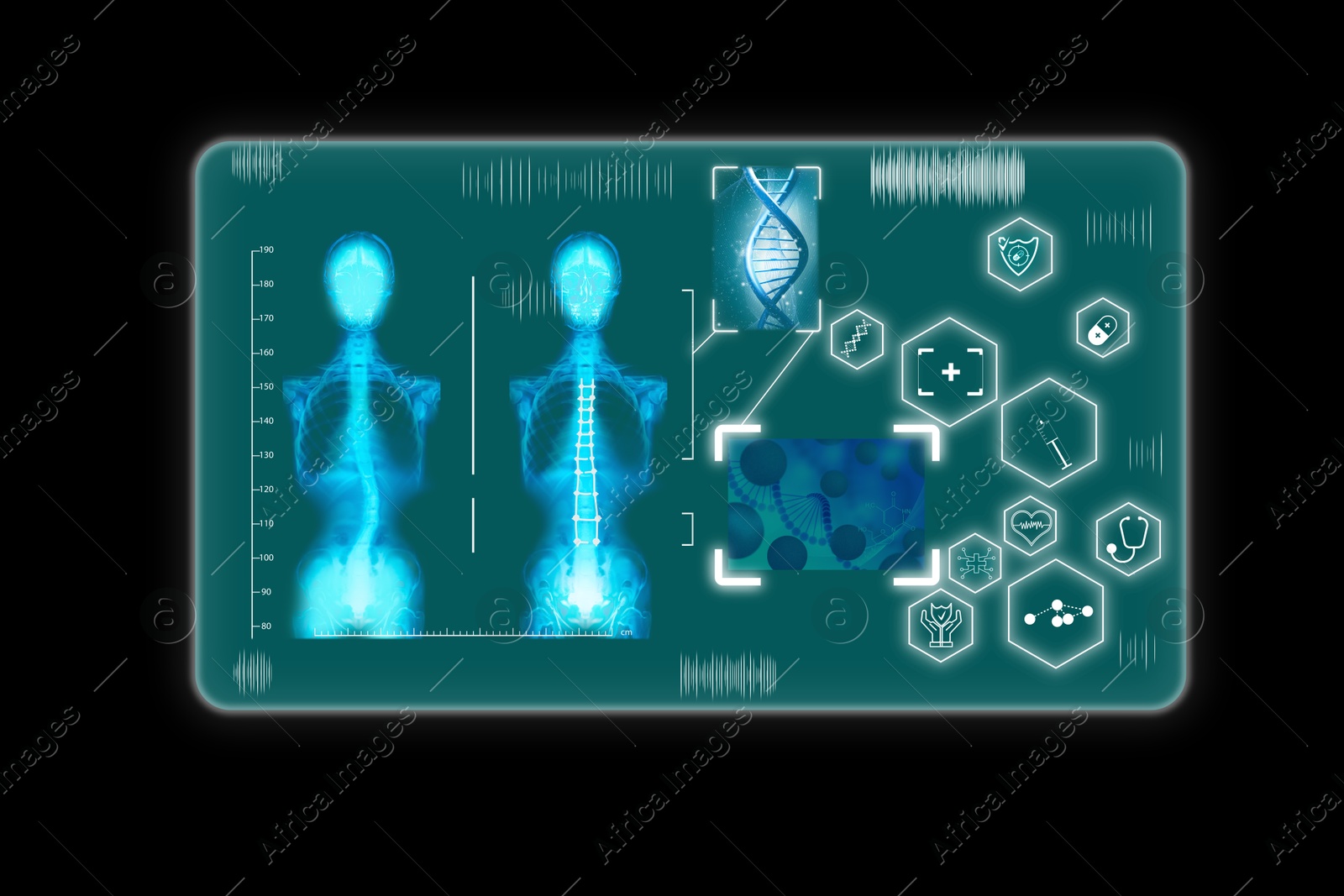 Image of Medical technology. Virtual frame with human skeleton x-ray, DNA, different icons and virus on black background, illustration