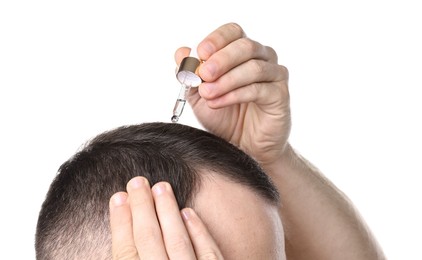 Photo of Baldness problem. Man applying serum onto hairline on white background, closeup