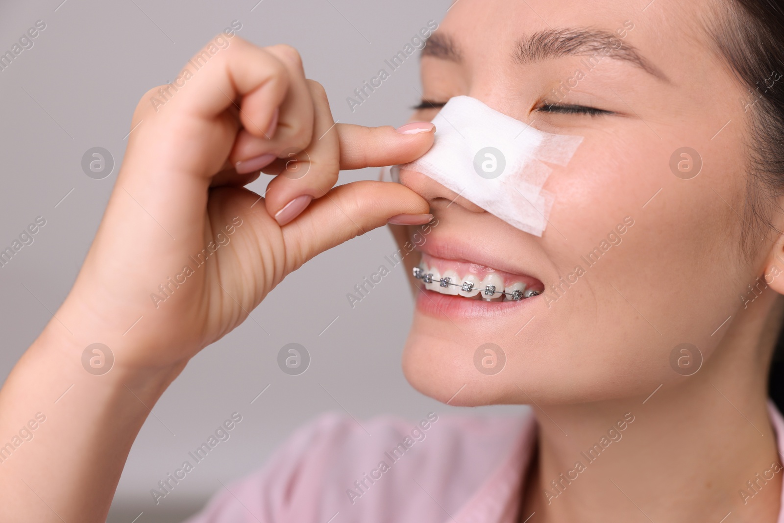 Photo of Woman with medical bandage on her nose after plastic surgery operation against light grey background, closeup