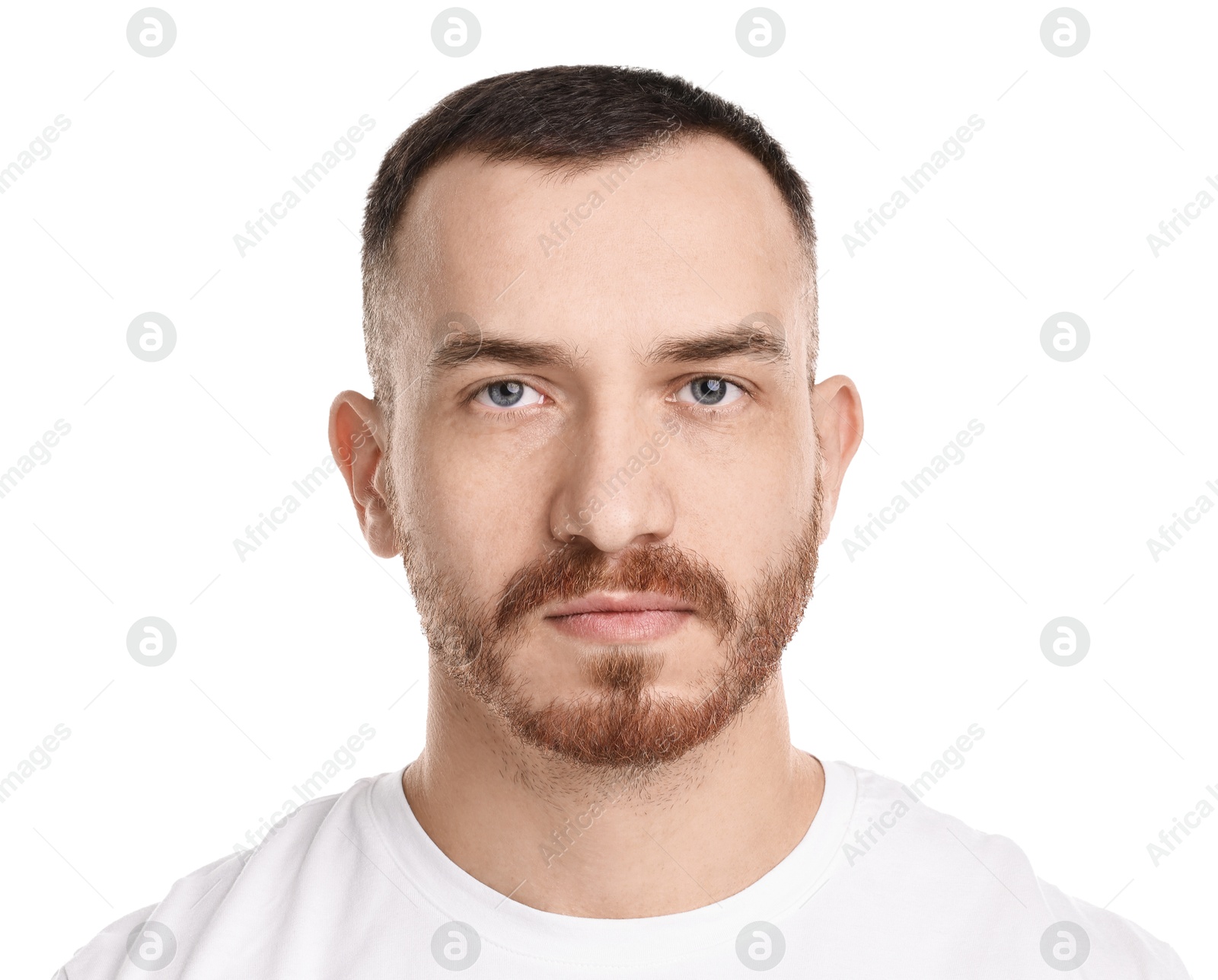 Photo of Baldness problem. Man with receding hairline on white background