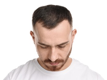 Photo of Baldness problem. Man with receding hairline on white background