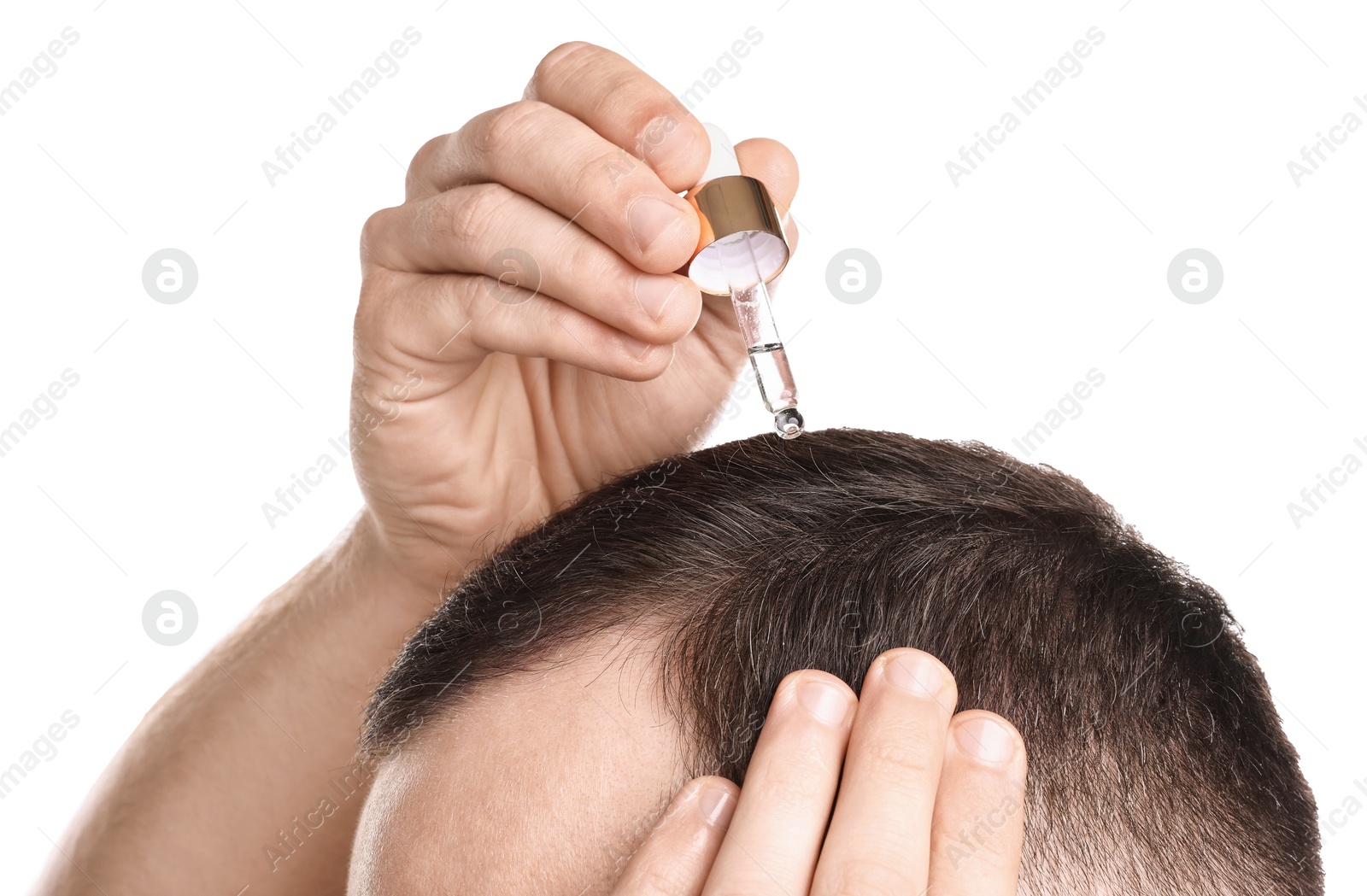 Photo of Baldness problem. Man applying serum onto hairline on white background, closeup