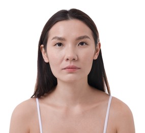 Photo of Woman with beautiful nose on white background. Rhinoplasty surgery