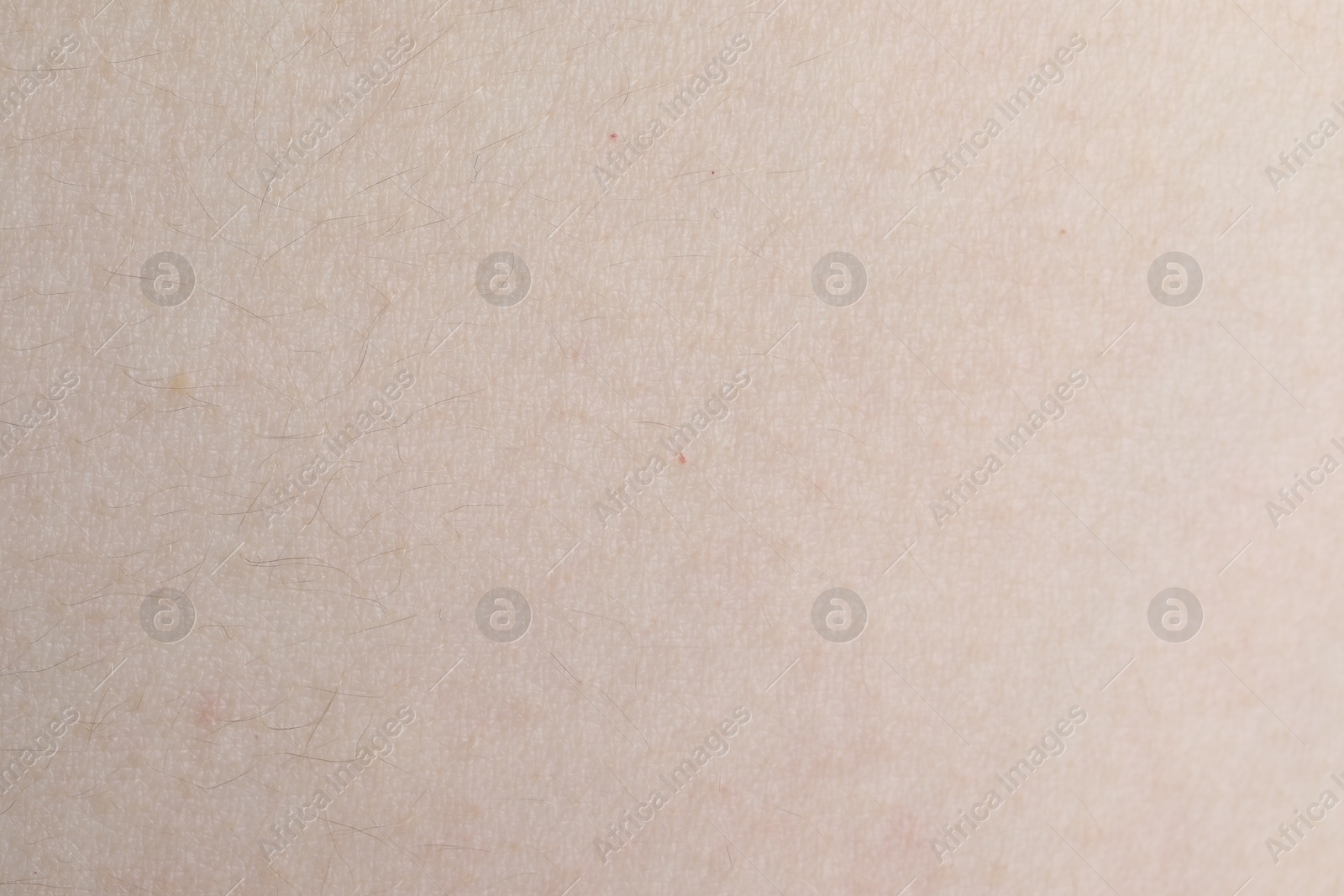 Photo of Texture of healthy skin as background, closeup