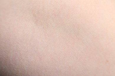 Photo of Texture of healthy skin as background, closeup