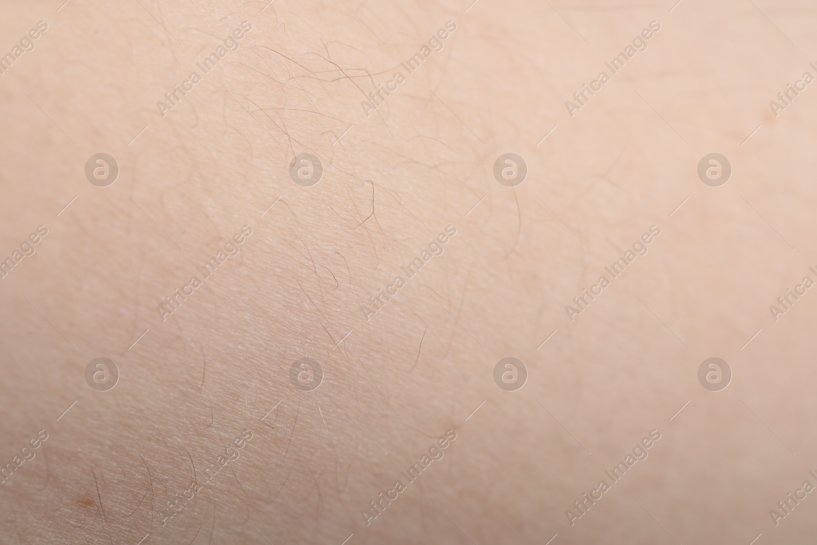 Photo of Texture of healthy skin as background, closeup