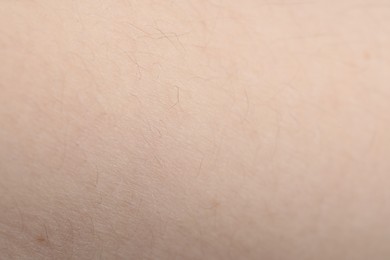 Photo of Texture of healthy skin as background, closeup