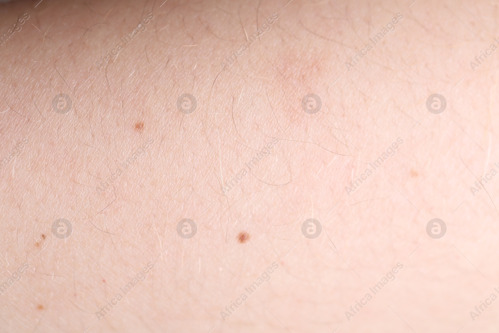 Photo of Texture of healthy skin as background, closeup