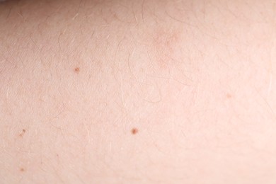 Photo of Texture of healthy skin as background, closeup