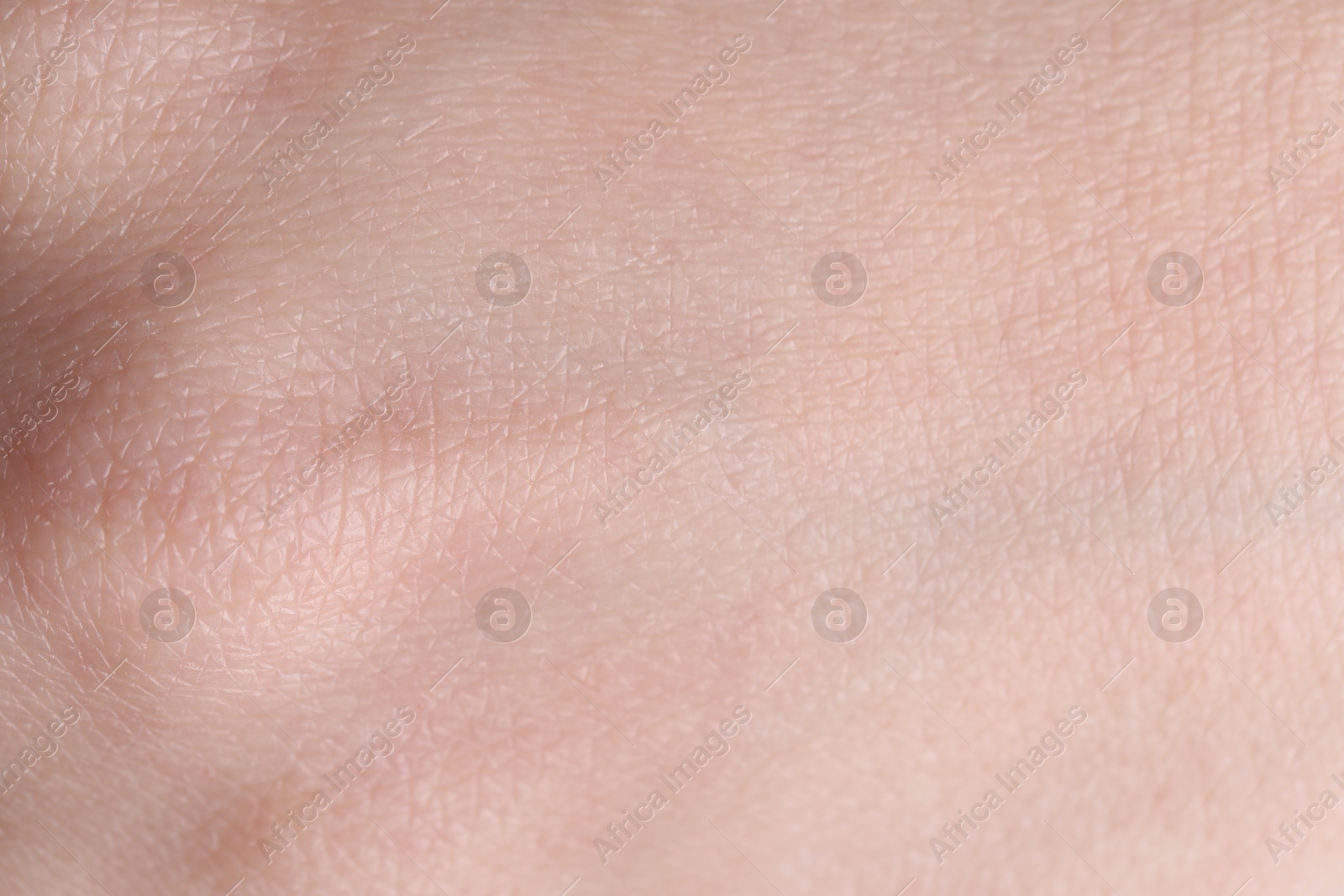 Photo of Texture of healthy skin as background, closeup