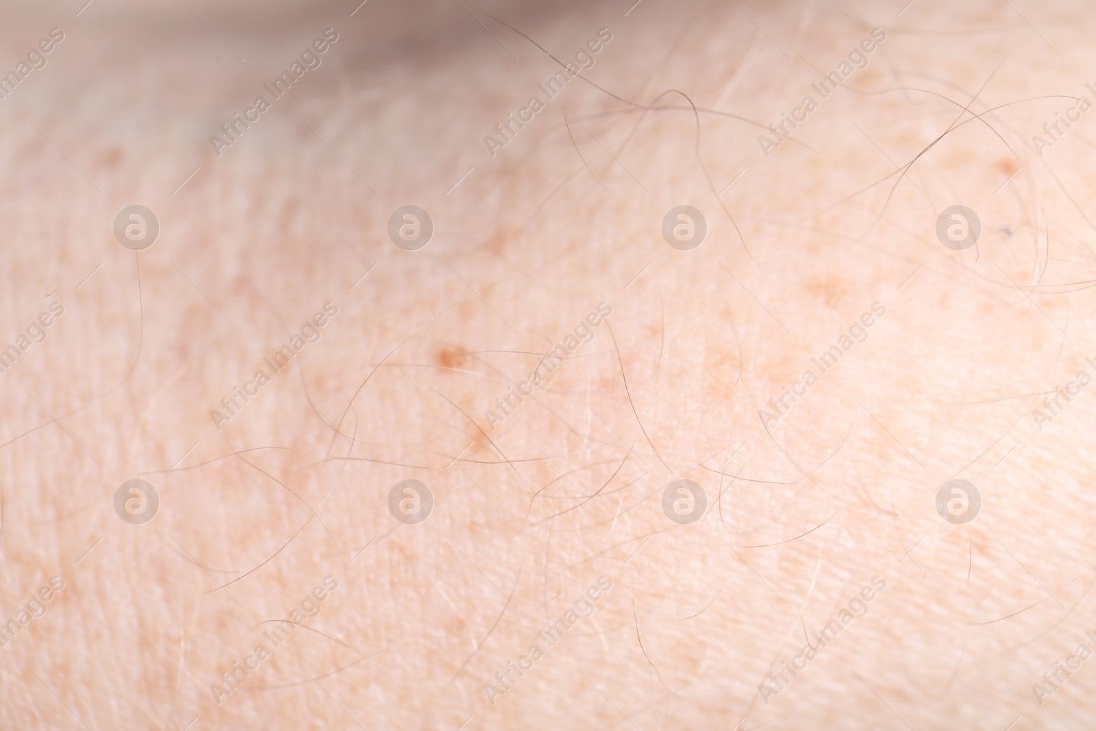 Photo of Texture of healthy skin as background, closeup