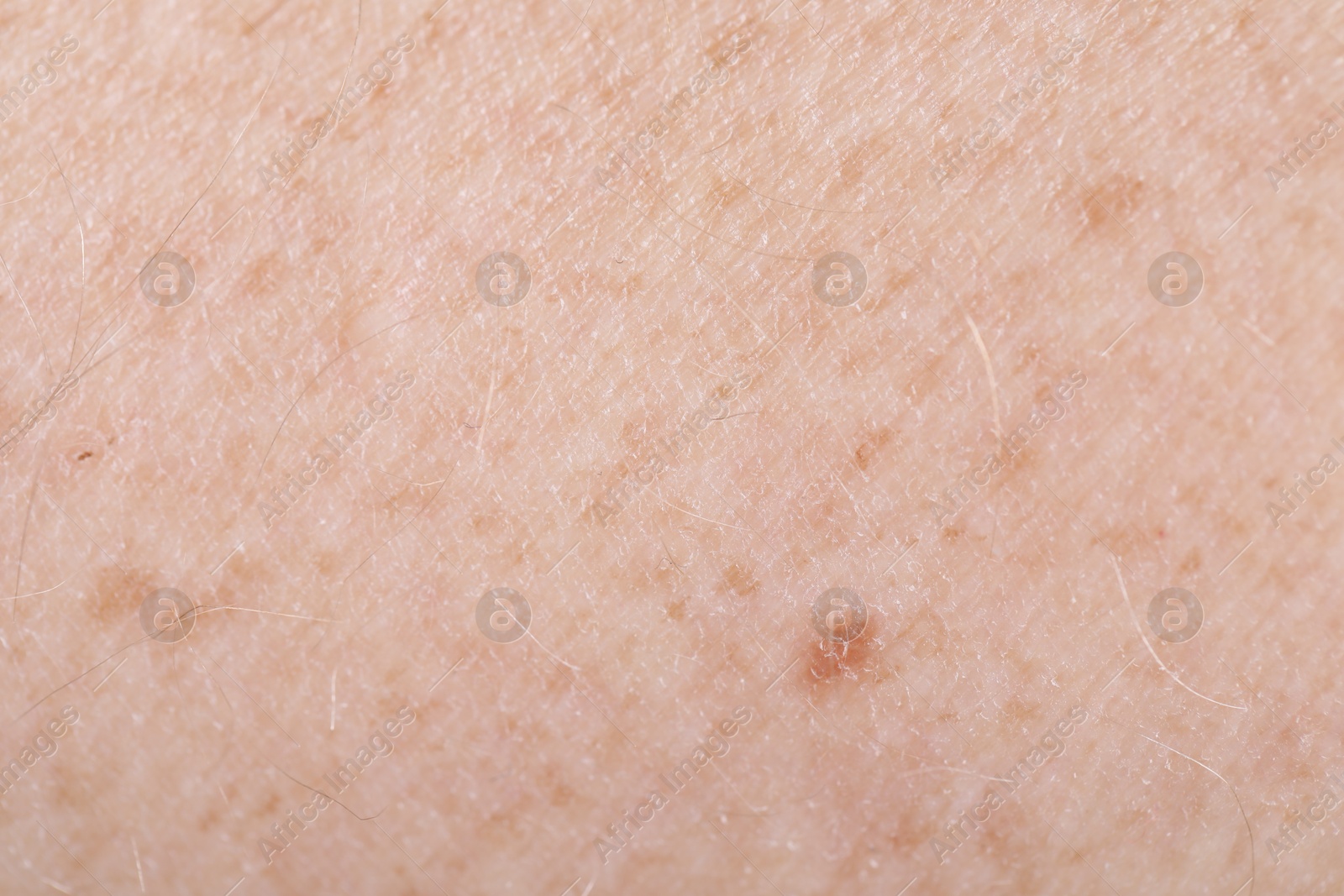 Photo of Texture of healthy skin as background, closeup