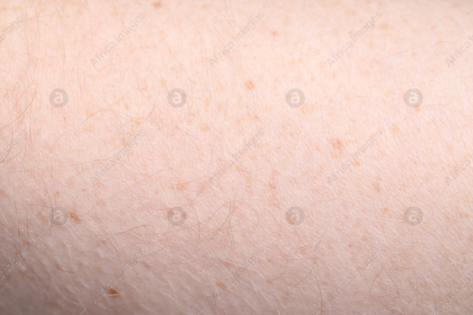 Photo of Texture of healthy skin as background, closeup