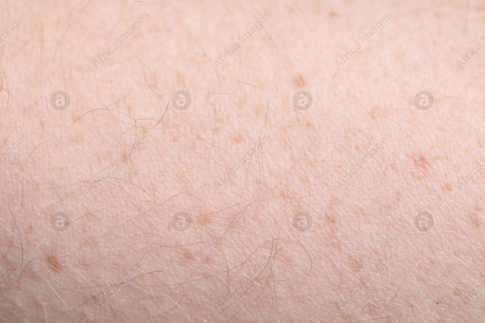 Photo of Texture of healthy skin as background, closeup