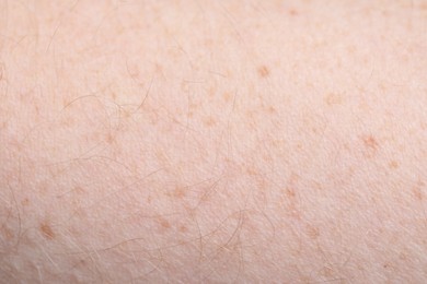 Photo of Texture of healthy skin as background, closeup