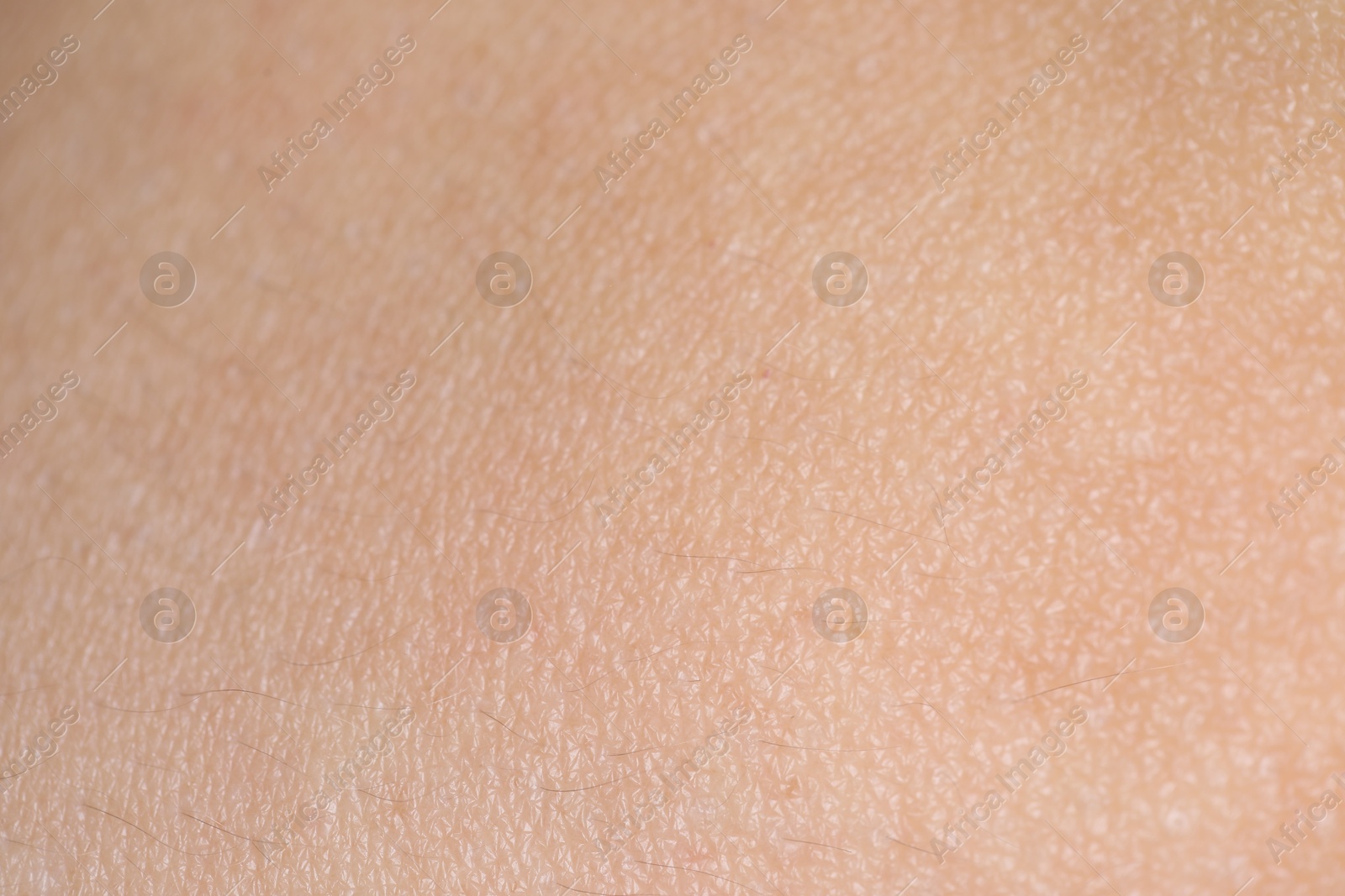 Photo of Texture of healthy skin as background, closeup