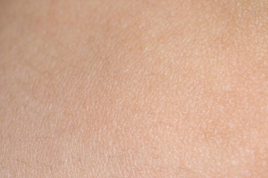 Photo of Texture of healthy skin as background, closeup