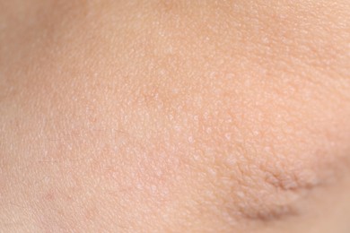 Photo of Texture of healthy skin as background, closeup