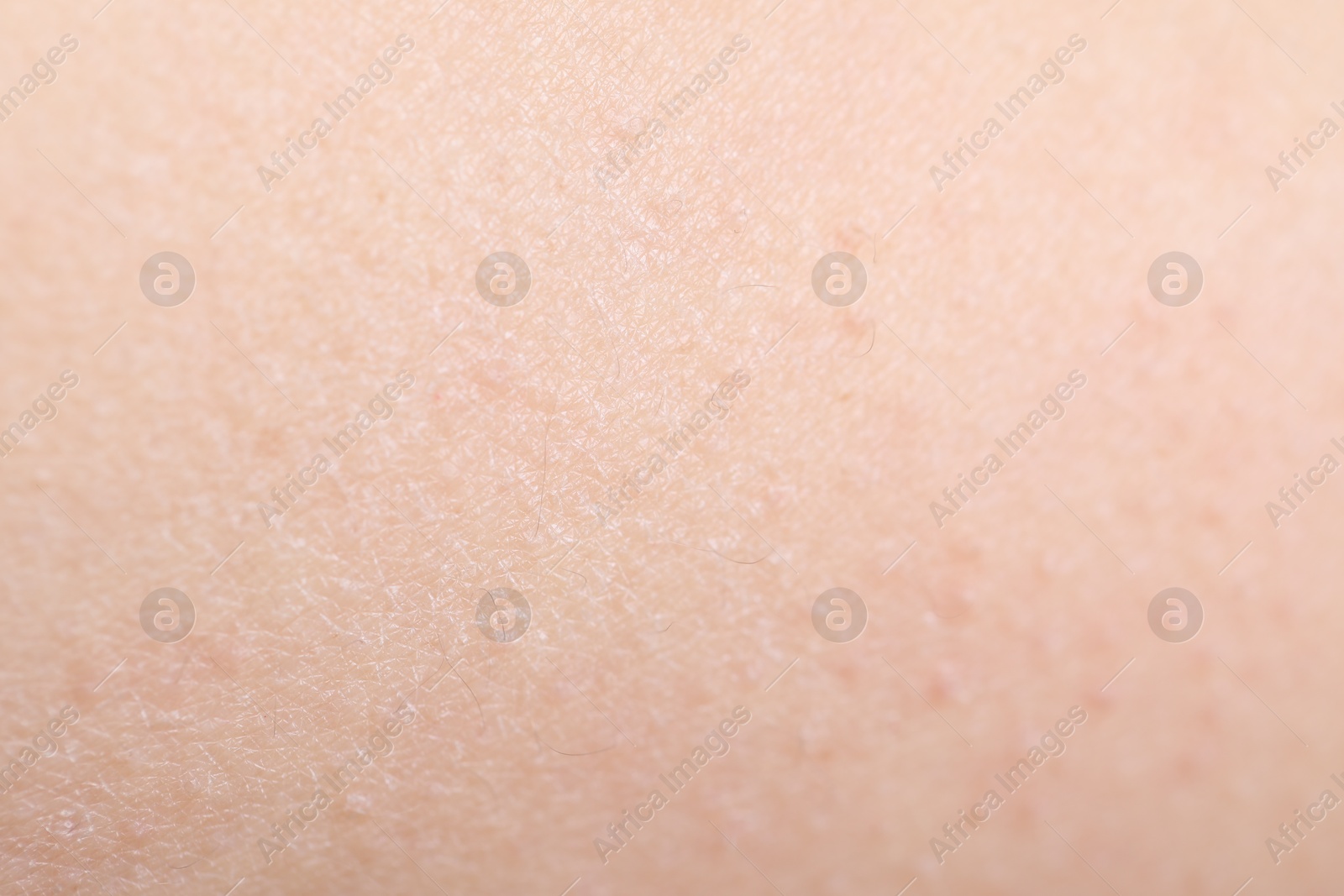 Photo of Texture of healthy skin as background, closeup