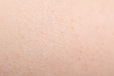 Photo of Texture of healthy skin as background, closeup