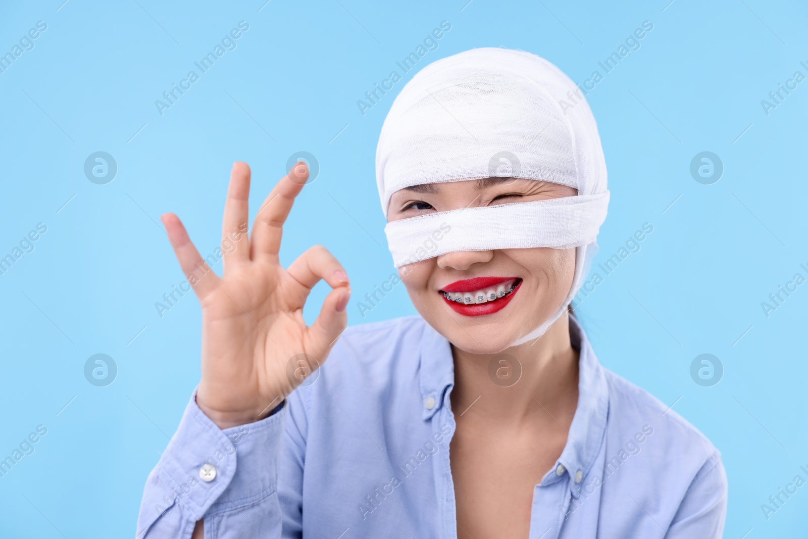 Photo of Woman with nose wrapped in medical bandage after plastic surgery operation showing ok gesture on light blue background