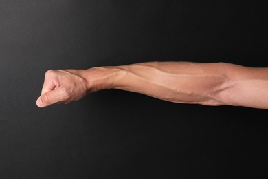 Photo of Man with bulging veins on his arm against black background, closeup