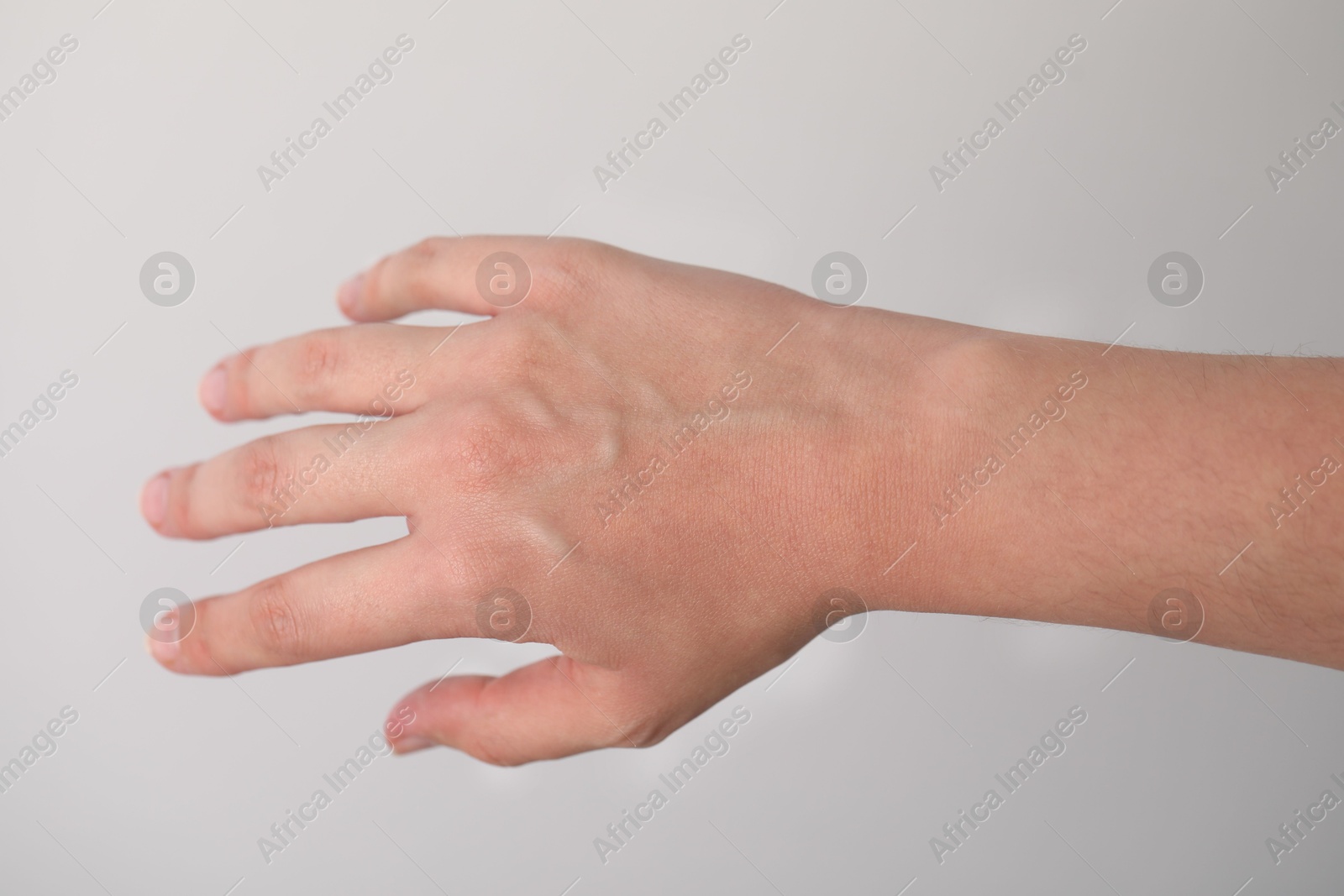 Photo of Woman with visible hand veins on light grey background, closeup