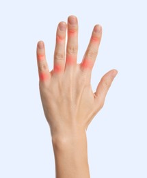 Image of Woman with joint inflammation on white background, closeup. Red areas on fingers