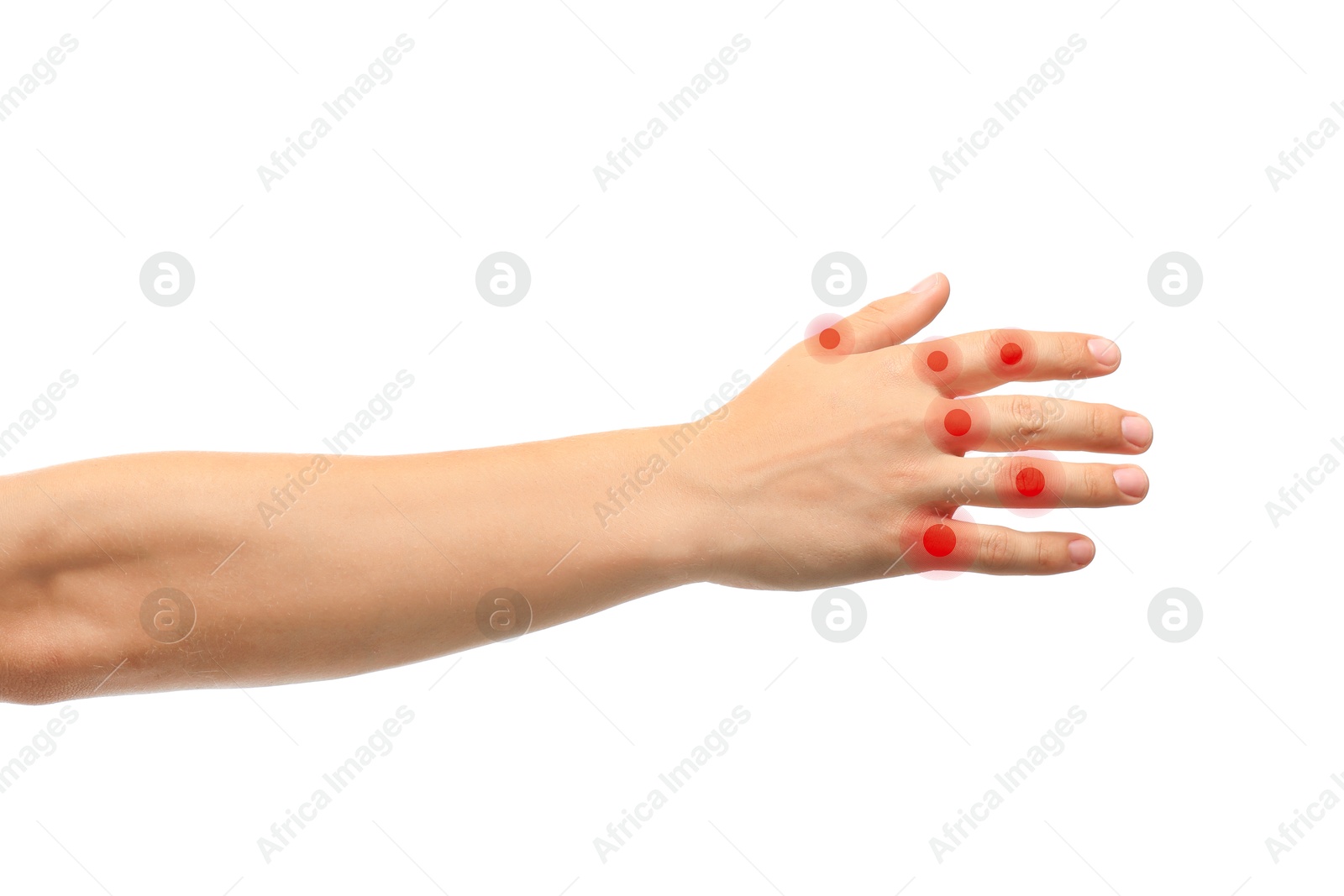 Image of Man with joint inflammation on white background, closeup. Red areas on fingers