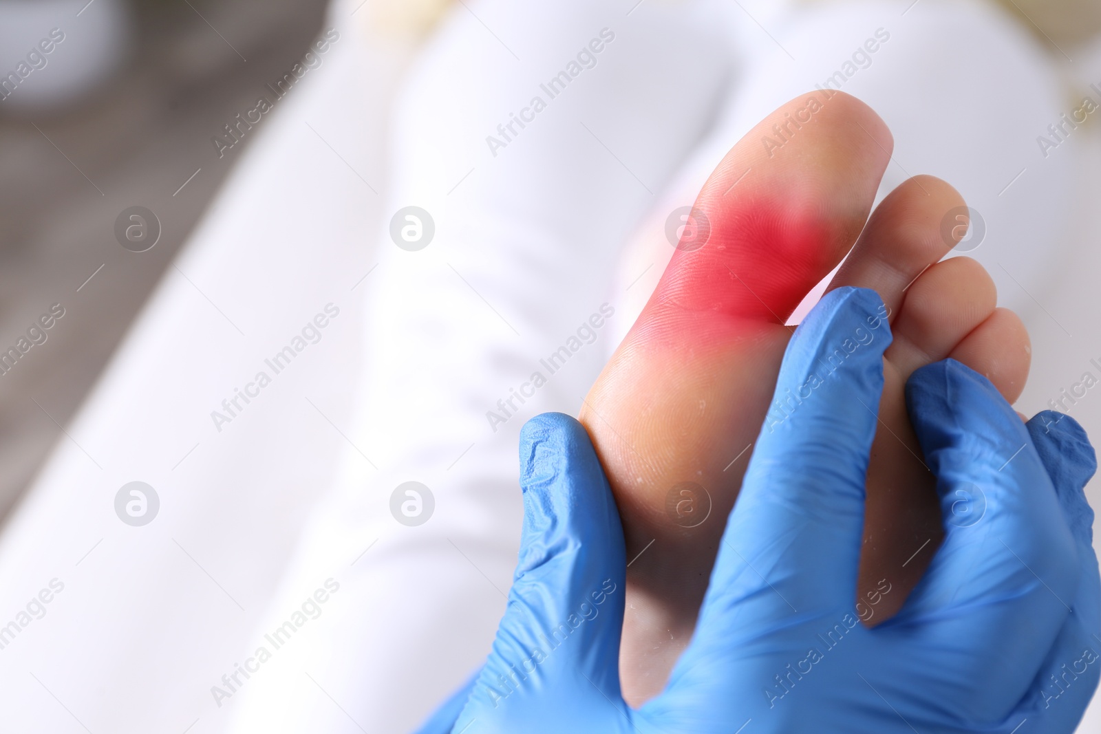 Image of Joint inflammation. Doctor checking woman's foot at hospital, closeup