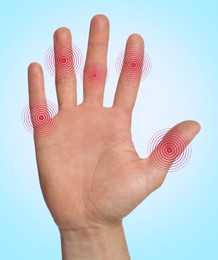 Image of Man with joint inflammation on light blue background, closeup. Red areas on fingers