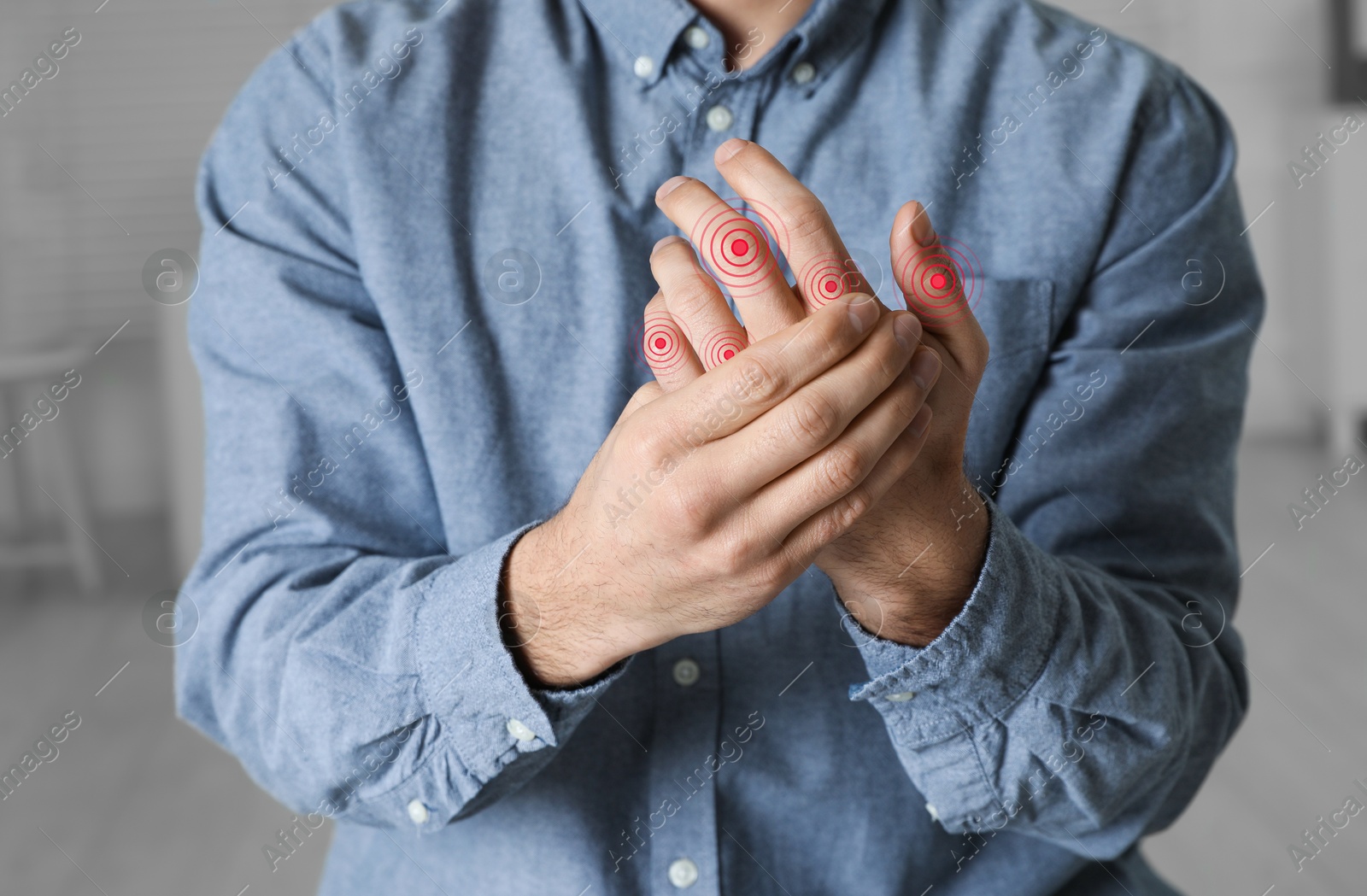 Image of Man with joint inflammation indoors, closeup. Red areas on fingers