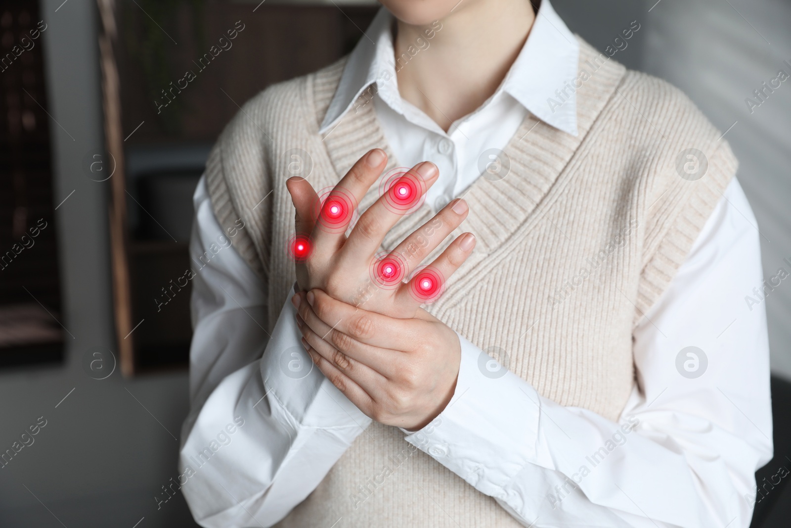 Image of Woman with joint inflammation indoors, closeup. Red areas on fingers