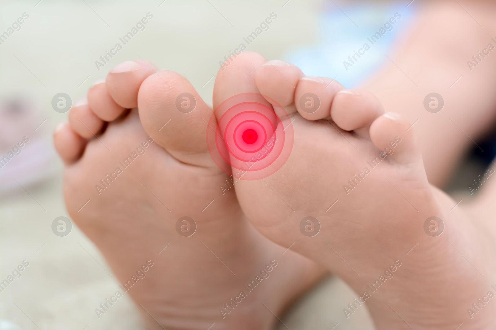 Image of Woman with joint inflammation, closeup. Highlighted area on toe