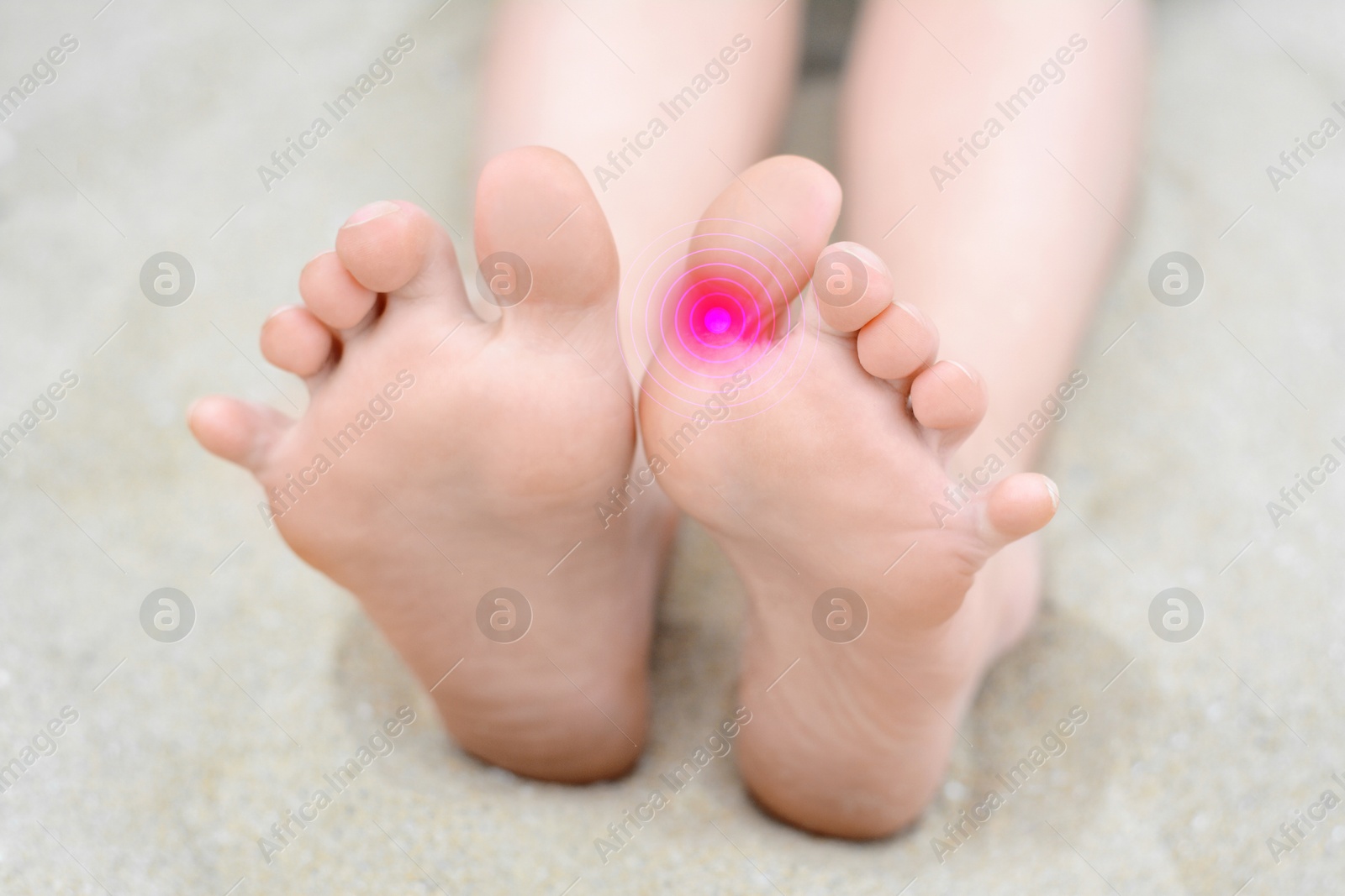 Image of Woman with joint inflammation, closeup. Highlighted area on toe