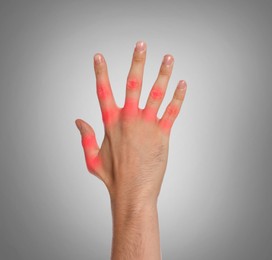 Image of Man with joint inflammation on grey background, closeup. Red areas on fingers