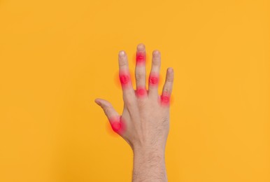 Image of Man with joint inflammation on orange background, closeup. Red areas on fingers