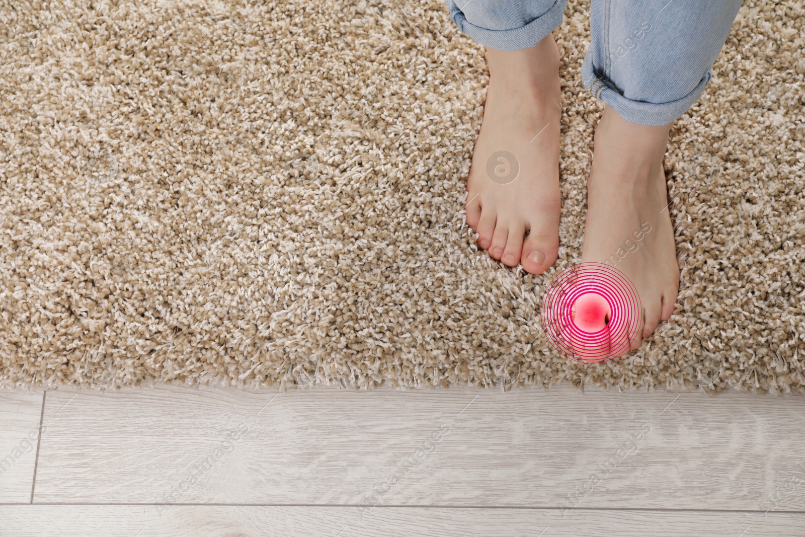 Image of Woman with joint inflammation indoors, closeup. Highlighted area on toe