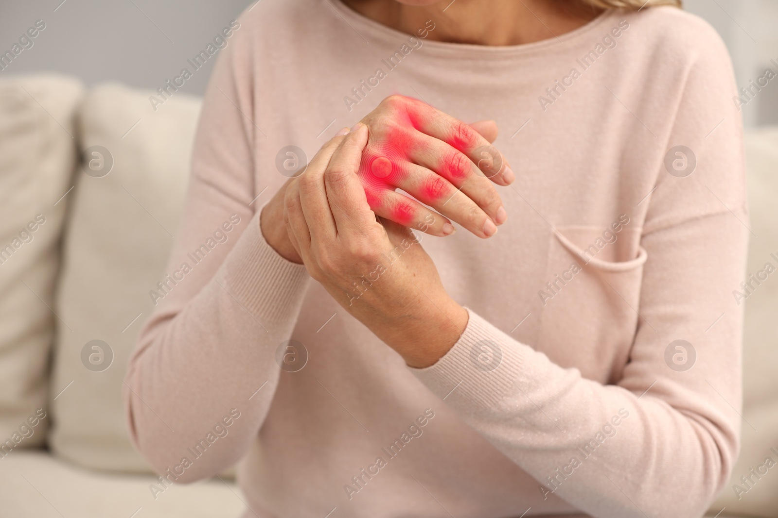 Image of Woman with joint inflammation indoors, closeup. Red areas on fingers