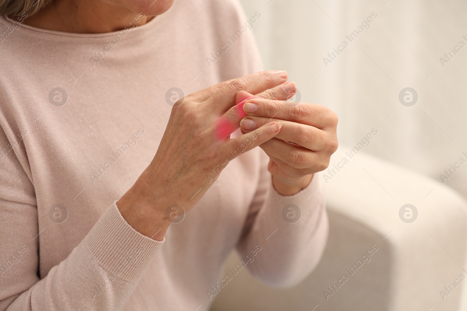 Image of Woman with joint inflammation indoors, closeup. Red areas on fingers