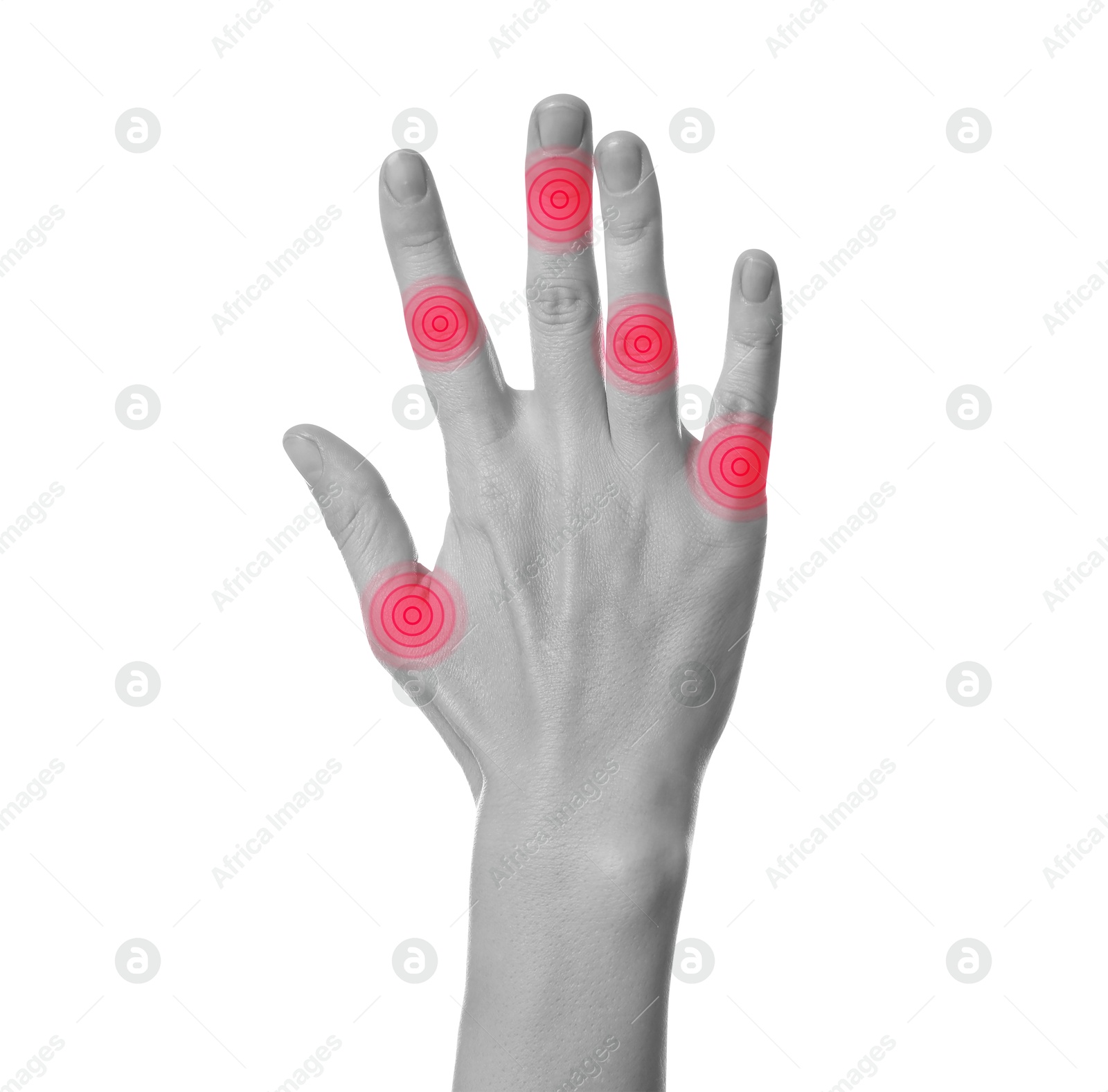 Image of Woman with joint inflammation on white background, closeup. Toned in black-and-white with color areas on fingers