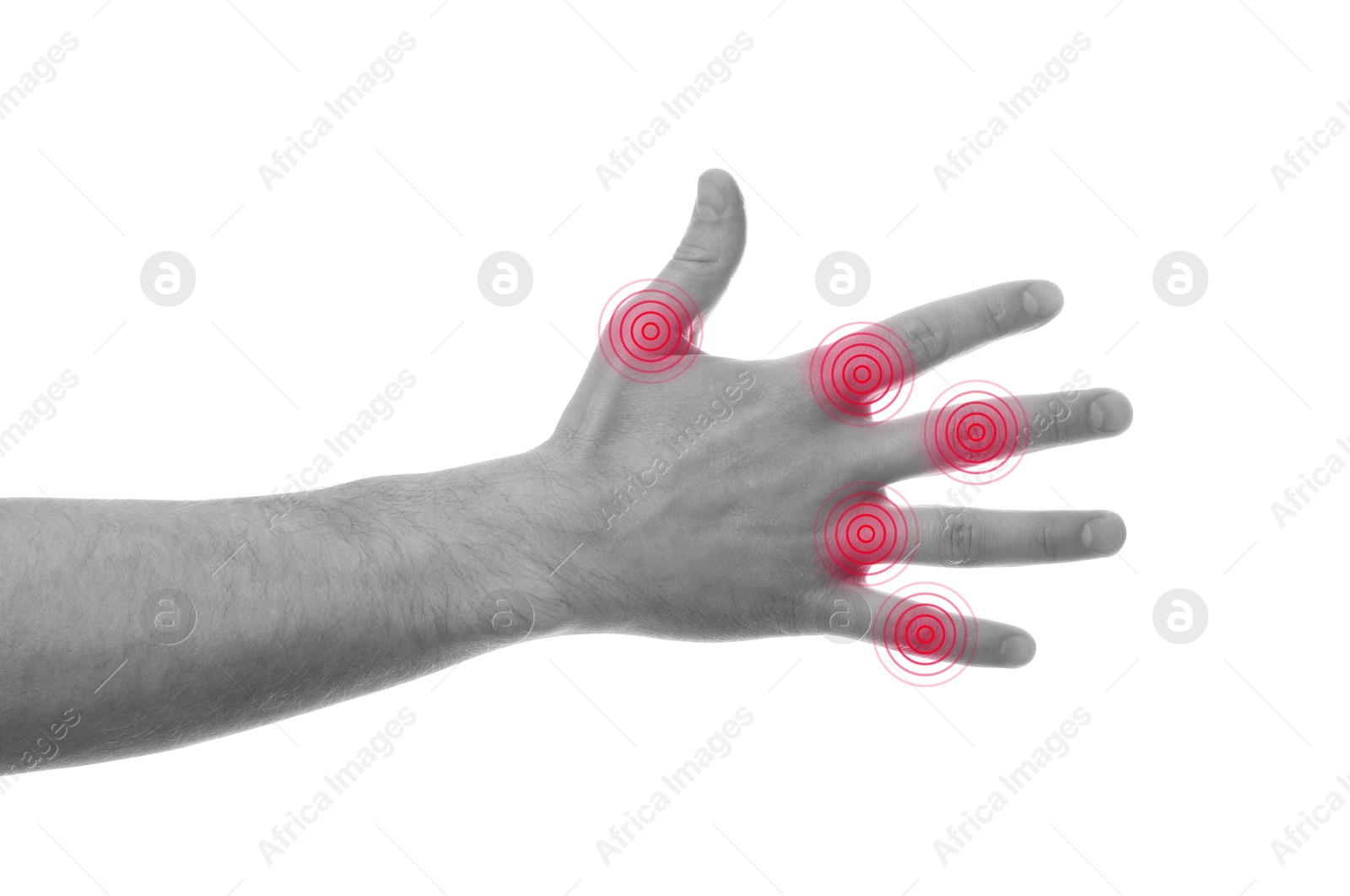 Image of Man with joint inflammation on white background, closeup. Toned in black-and-white with color areas on fingers