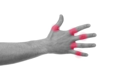 Image of Man with joint inflammation on white background, closeup. Toned in black-and-white with color areas on fingers