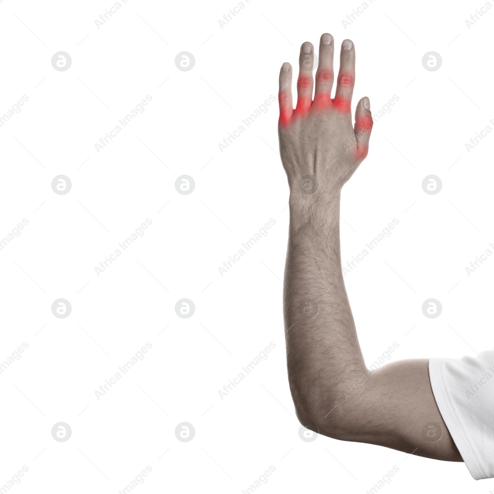 Image of Man with joint inflammation on white background, closeup. Toned in black-and-white with color areas on fingers