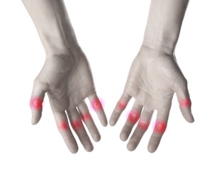 Image of Woman with joint inflammation on white background, closeup. Toned in black-and-white with color areas on fingers