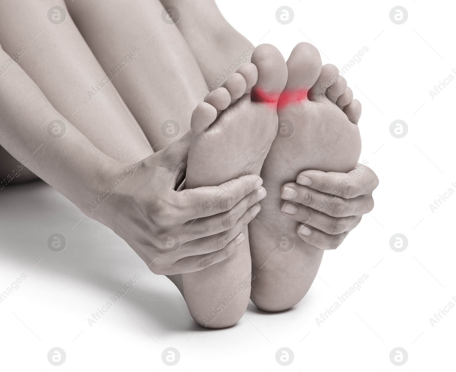 Image of Woman with joint inflammation on white background, closeup. Toned in black-and-white with color areas on toes