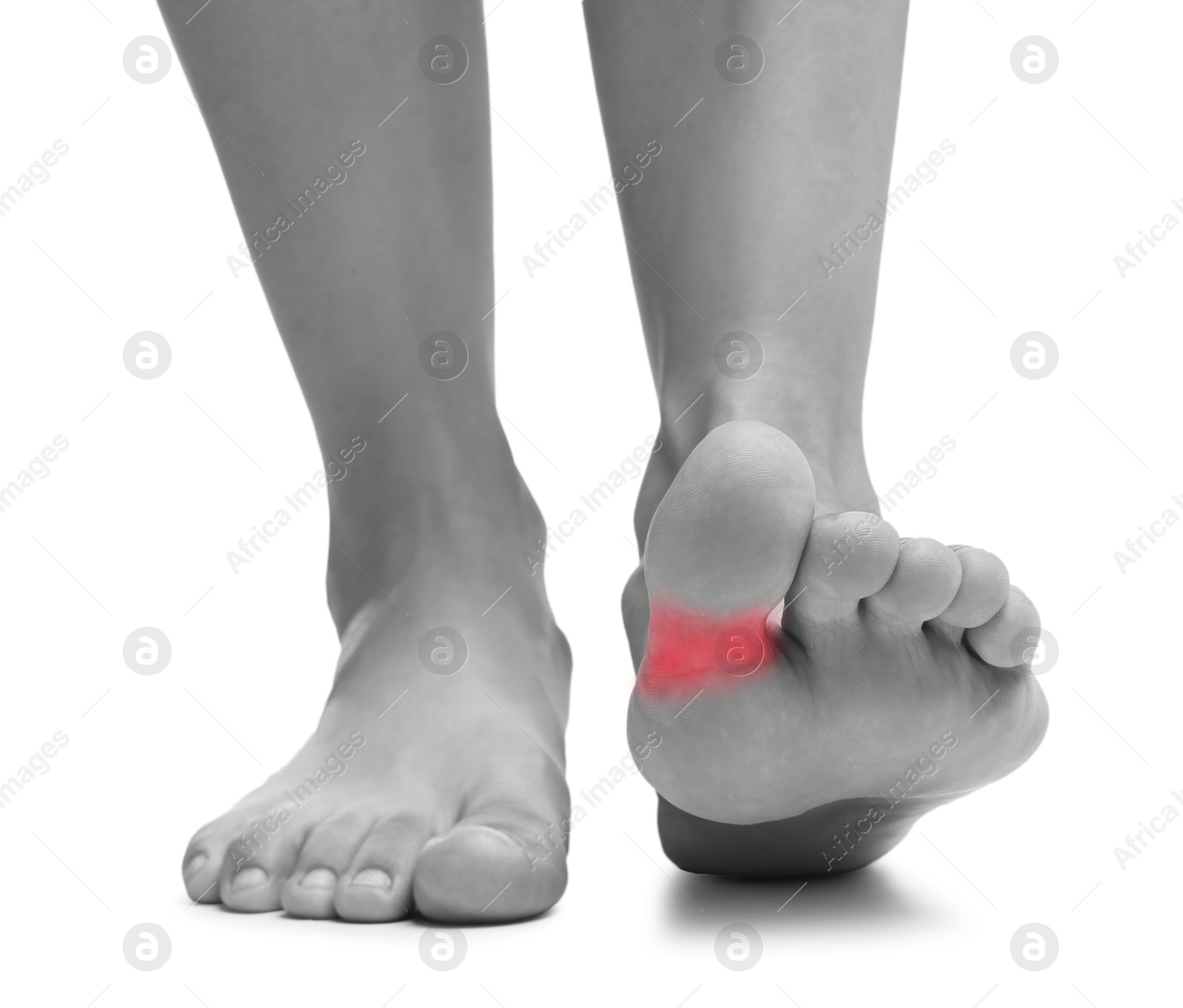 Image of Woman with joint inflammation on white background, closeup. Toned in black-and-white with color area on toe