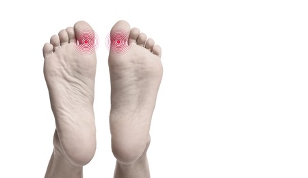 Image of Woman with joint inflammation on white background, closeup. Toned in black-and-white with color areas on toes