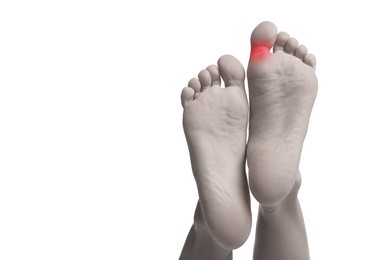 Image of Woman with joint inflammation on white background, closeup. Toned in black-and-white with color area on toe