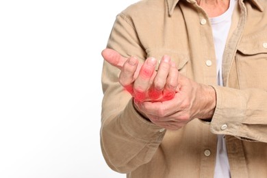 Image of Man with joint inflammation on white background, closeup. Red areas on fingers